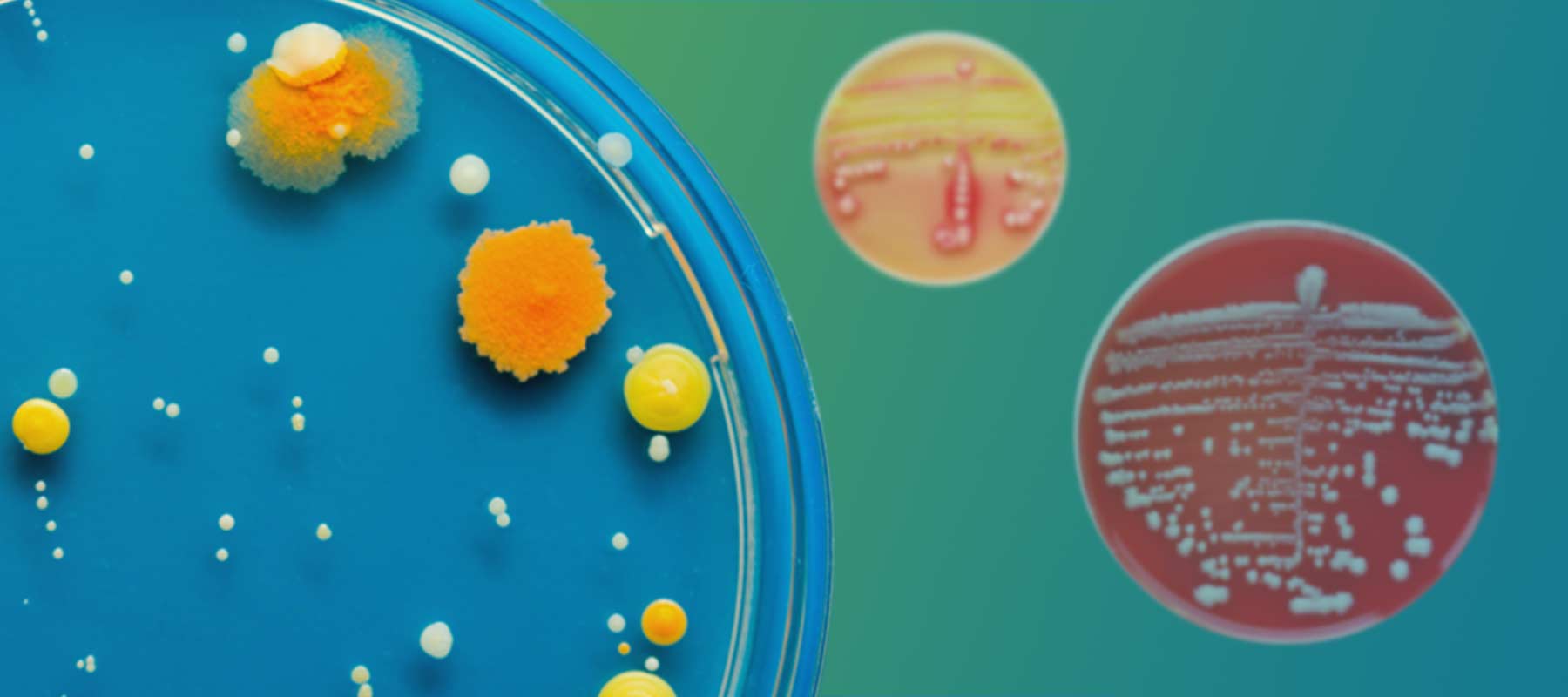 Bacterial Colony Morphology 101