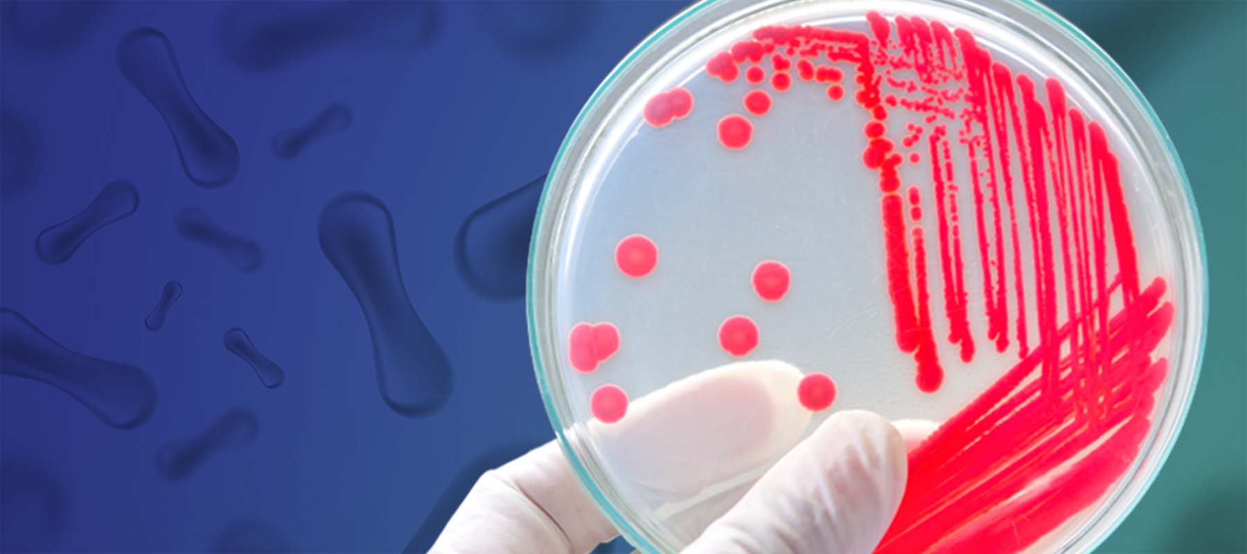 Image of petri dish with bacteria for article on colony picking.