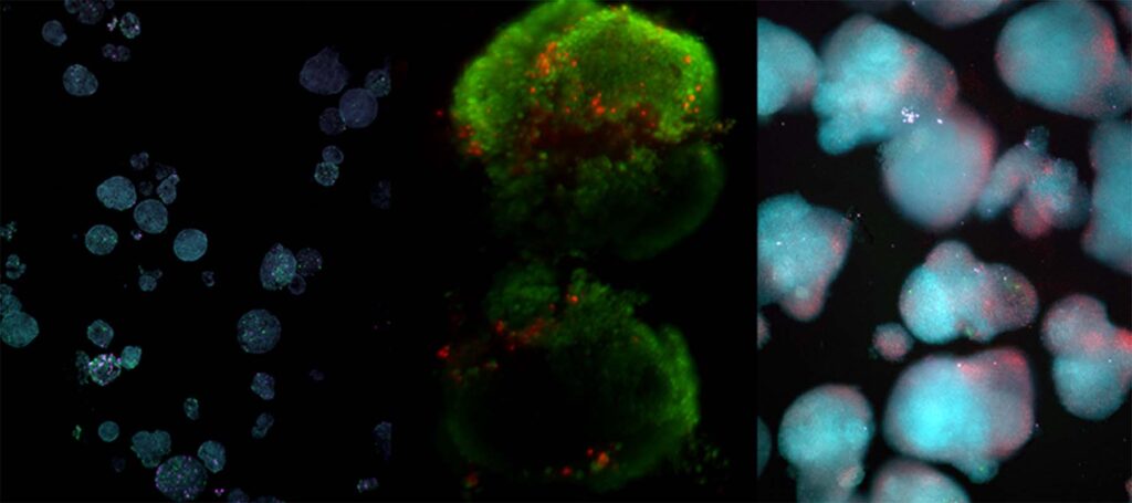 How Hudson and Ramona Optics Are Enabling Walk-Away Live-Cell Imaging