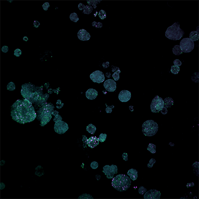 Human Intestinal Organoids in 4 Fluorescent Channels