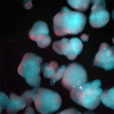 Human Kidney Organoids in 4 Fluorescent Channels