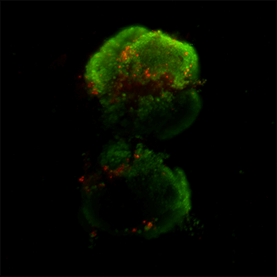 Human Neurovascular Units in Red and Green Fluoresces